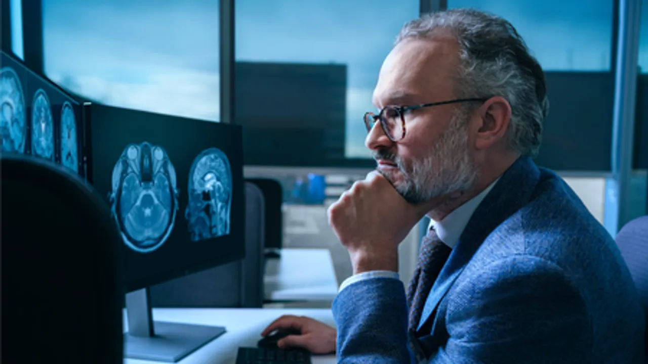  This new AI tool can detect 9 types of dementia from single brain scan