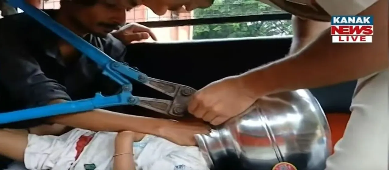  Malkangiri Fire personnel rescue toddler with head stuck in steel pitcher