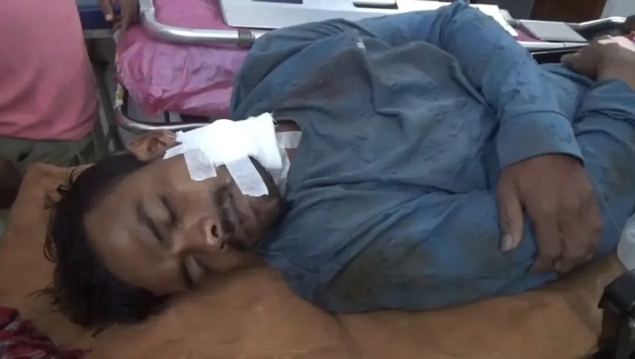  Odisha: Youth brutally hacked by friend, critical in Mayurbhanj