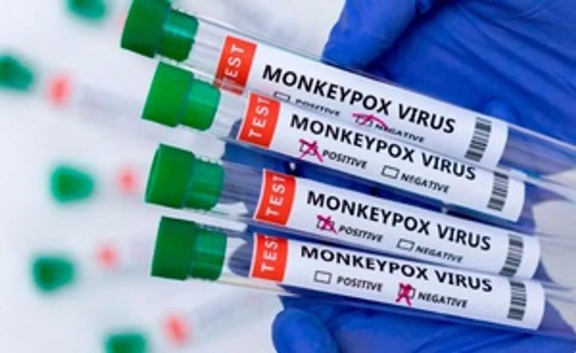  Mpox cases in Africa near 60,000 as 20 countries affected: Africa CDC