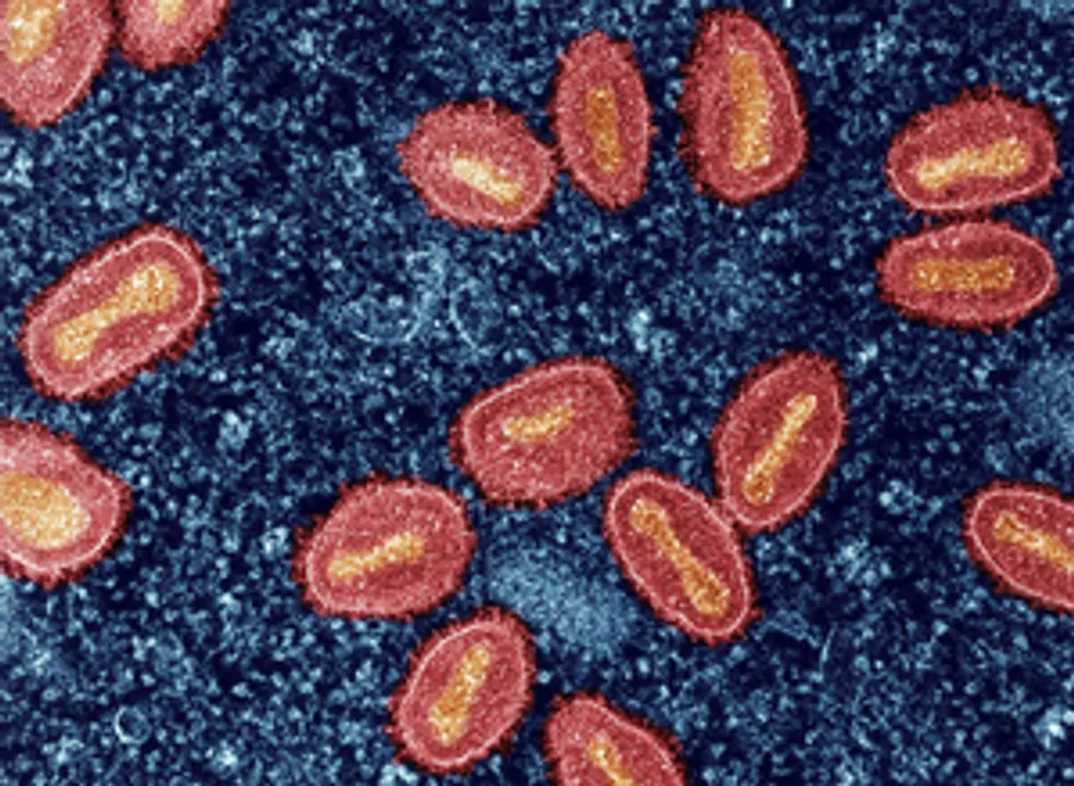  Mpox alert: Odisha asks Health officials, airport, seaport to be vigilant