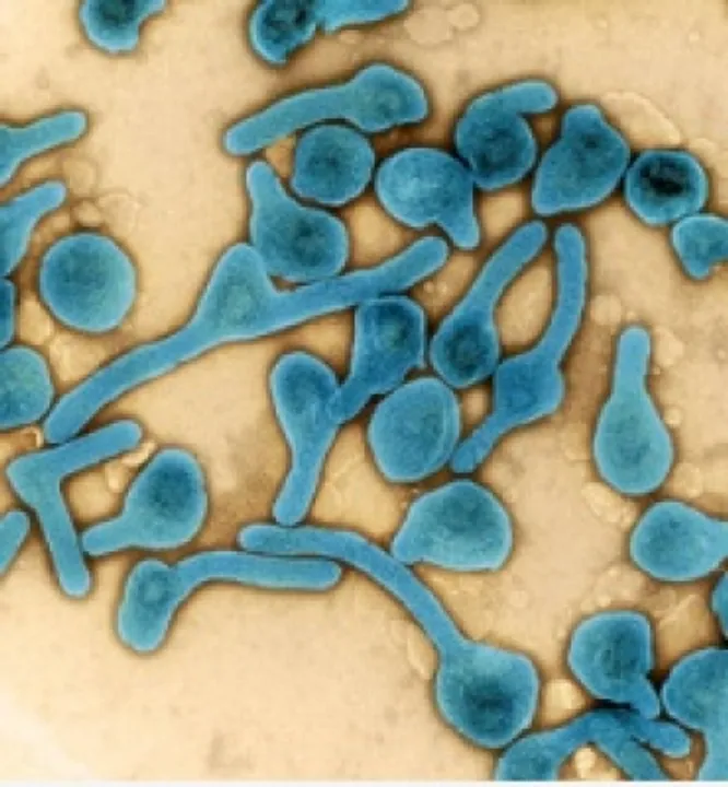  Rwanda records seven more Marburg virus disease cases