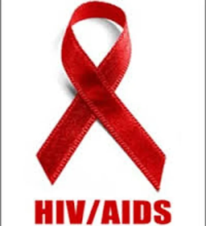  Cabinet approves amendments to HIV, AIDS Bill