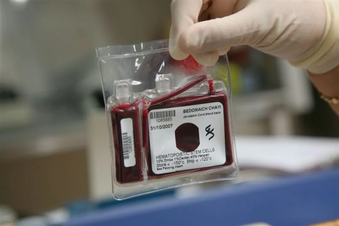  Private cord blood banks are fooling the public, say doctors