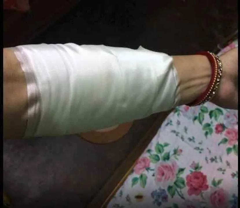  Miscreants attack couple, loot gold chain in Odisha capital
