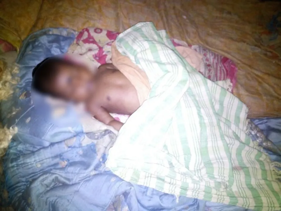  Two-month-old infant dies after administration of polio injection in Odisha!