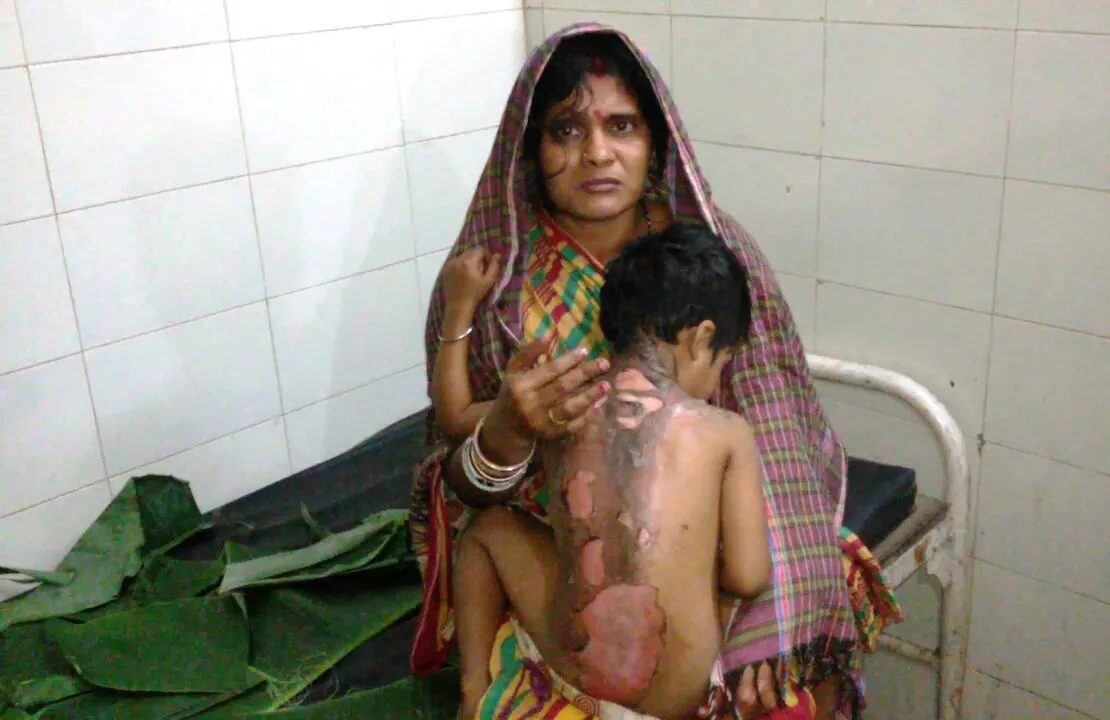  Shocking! Woman pours hot rice gruel on minor girl in Odisha
