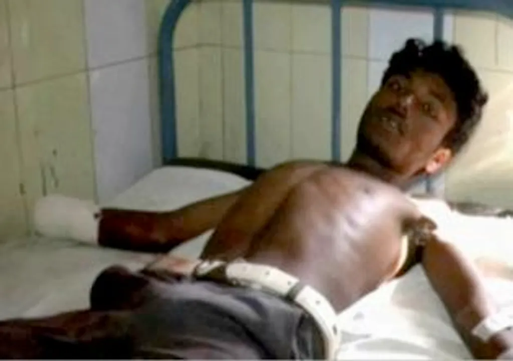  Labourers' hand chopping: Odisha court awards lifer to eight