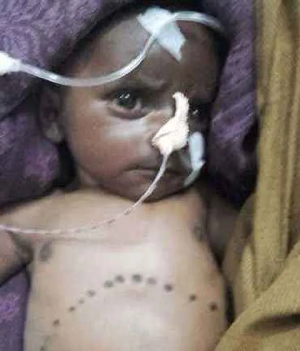  Two-month-old baby branded with hot seed dies in Odisha