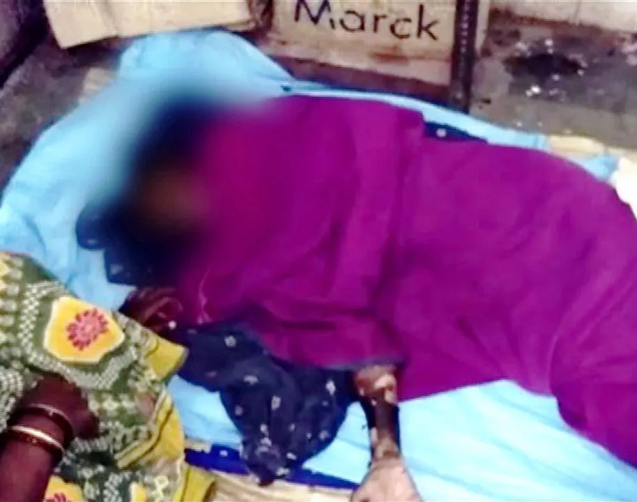  Rape attempt: Minor girl set on fire by miscreants in Odisha; hospitalised