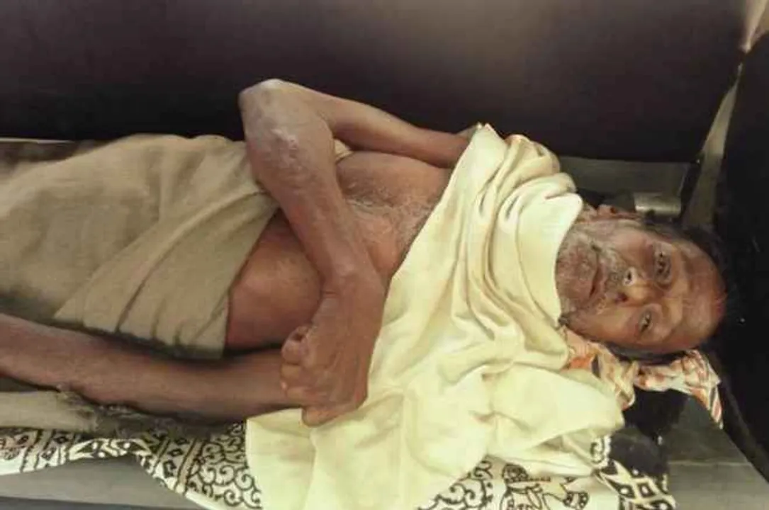  Old man critical in bear attack in Odisha's Balasore