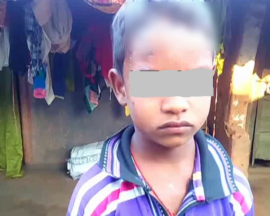  Eatery owner in Odisha throws hot food on minor for asking money