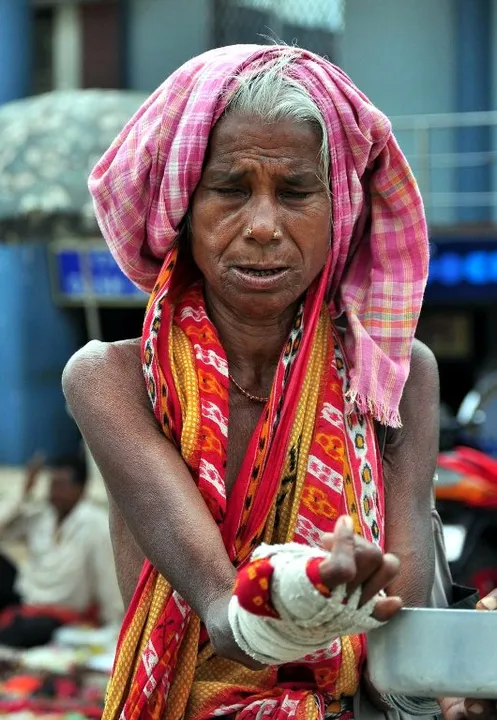  Odisha to be beggar-free state