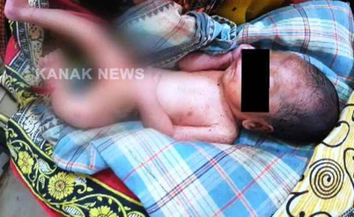  Baby girl rescued from bamboo bush in Odisha's Ganjam