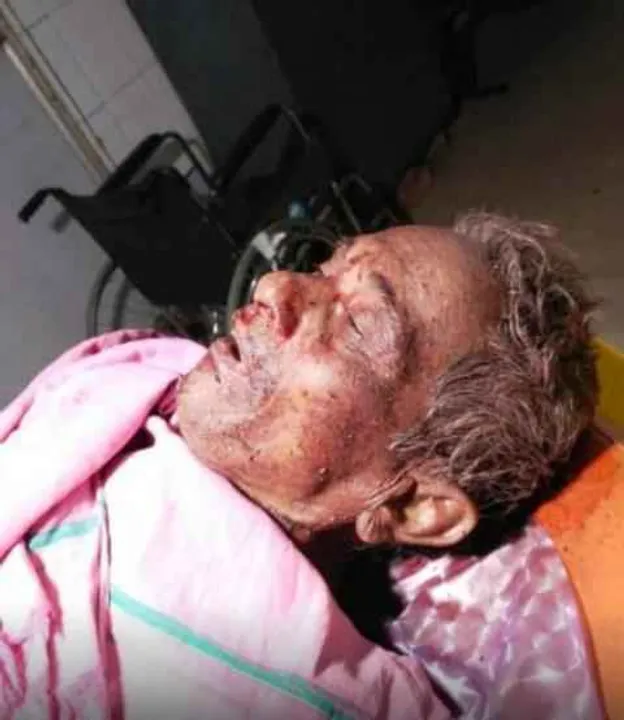  Elderly man dies in bear attack in Odisha's Angul
