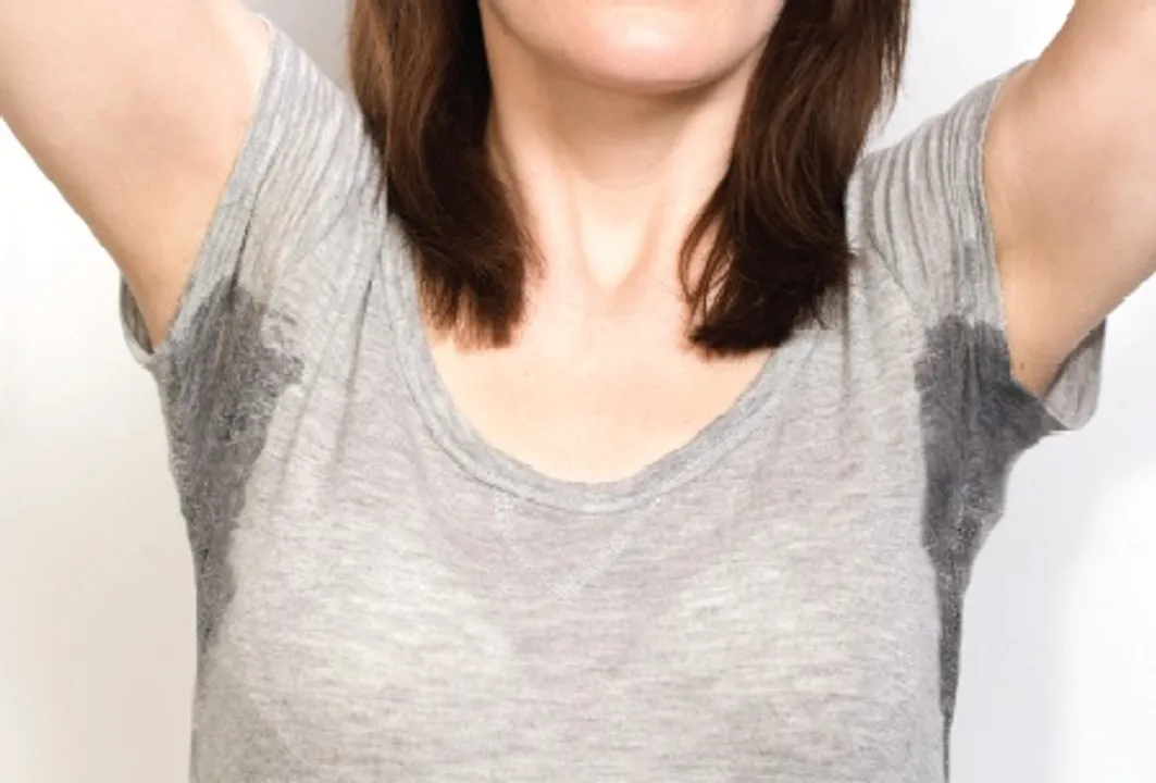  Pic Courtesy: International Hyperhidrosis Society 