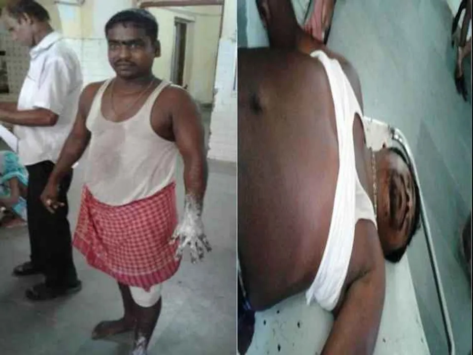  Hot dal falls on two Sri Mandir servitors; hospitalized with critical burn injuries