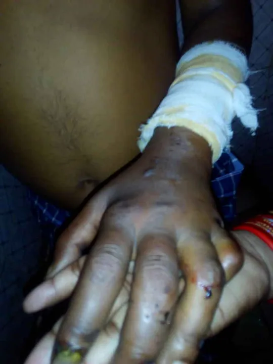  Undertrial prisoner dies at SCB hosp in Odisha, kin allege torture