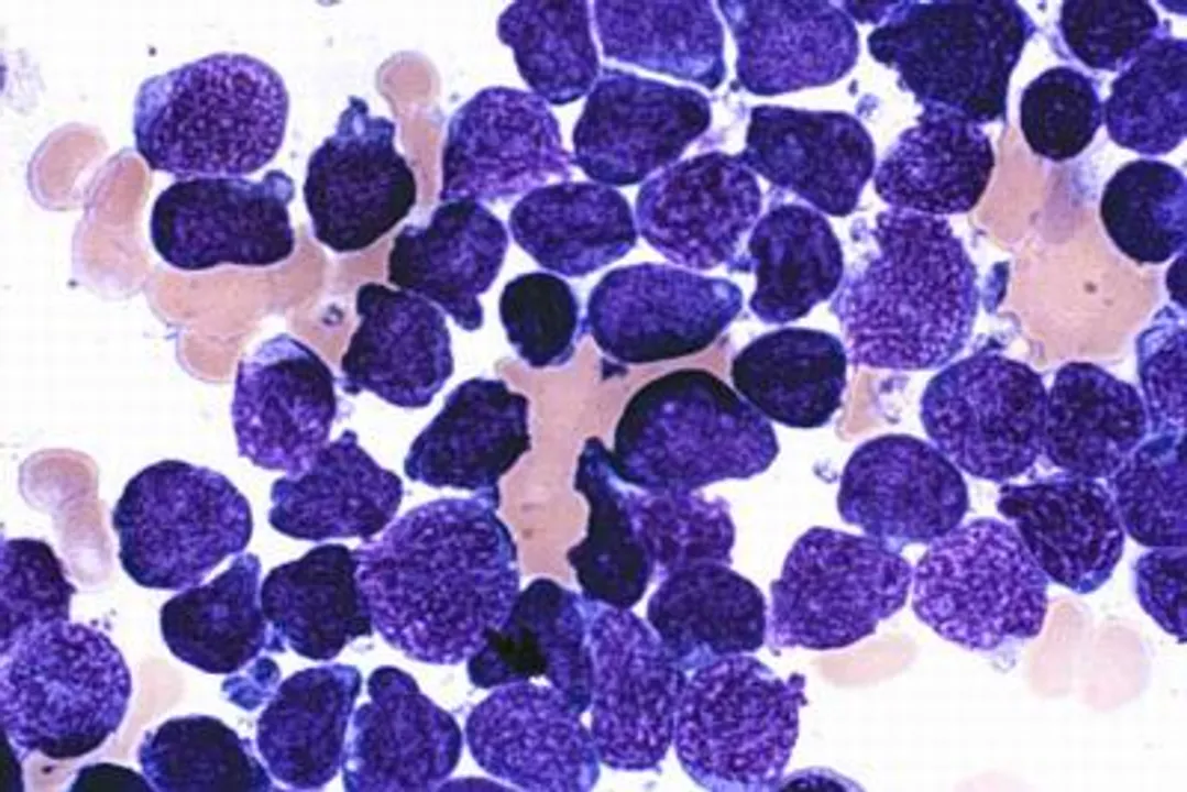  Indian-origin researcher discovers new drug for blood cancer patients