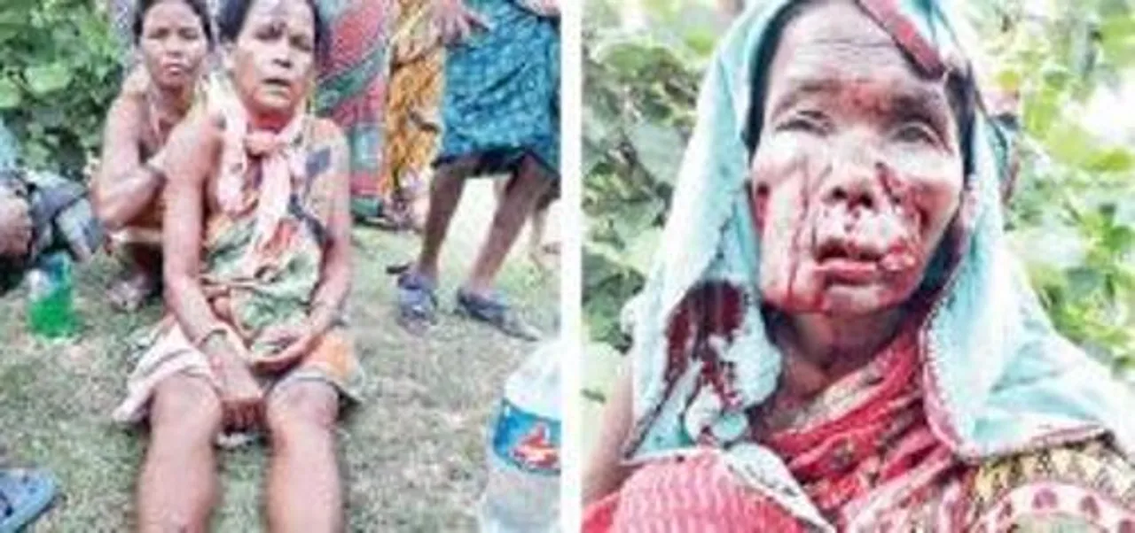  Royal Bengal tiger scare in Odisha: Three women critical in attack