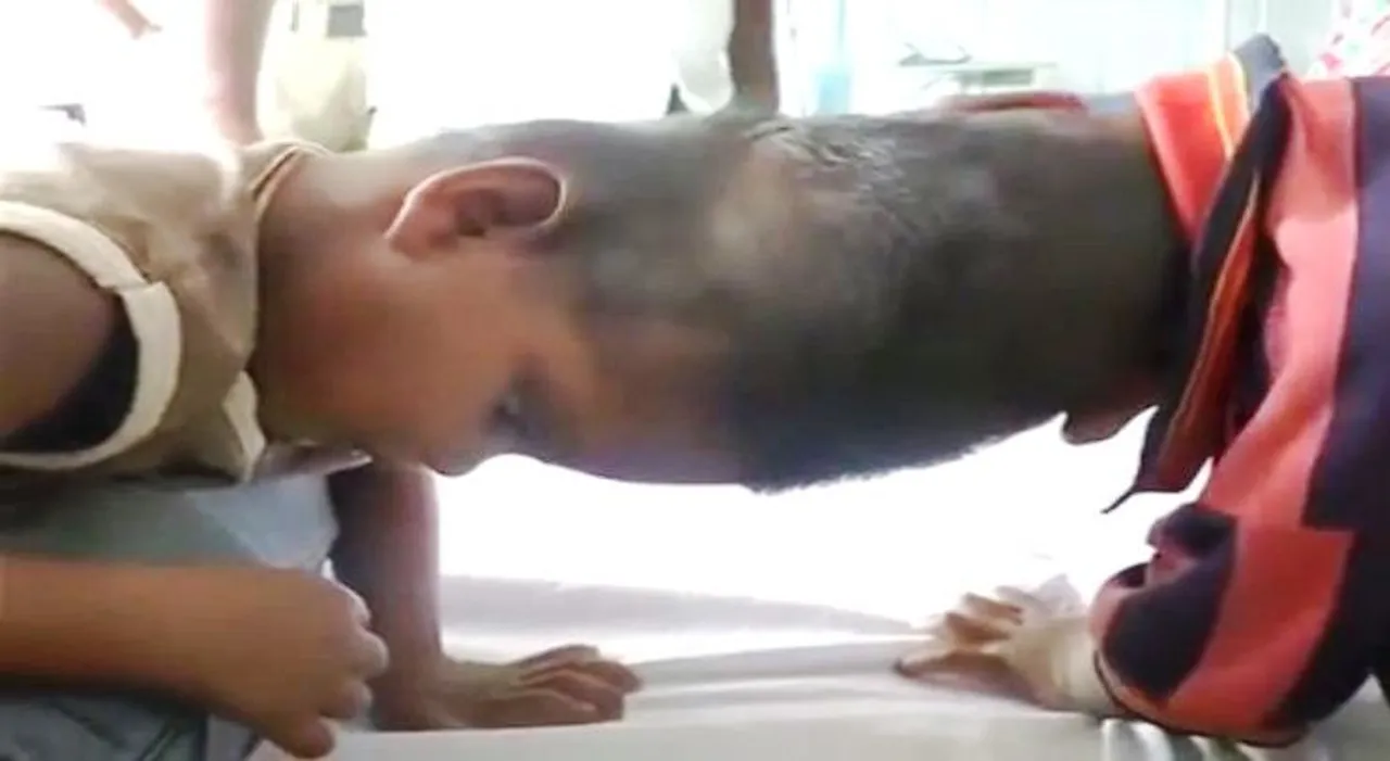  Kandhamal DM appeals to donate to conjoined twins