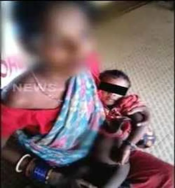  Superstition: Toddler branded with hot iron rod in Odisha