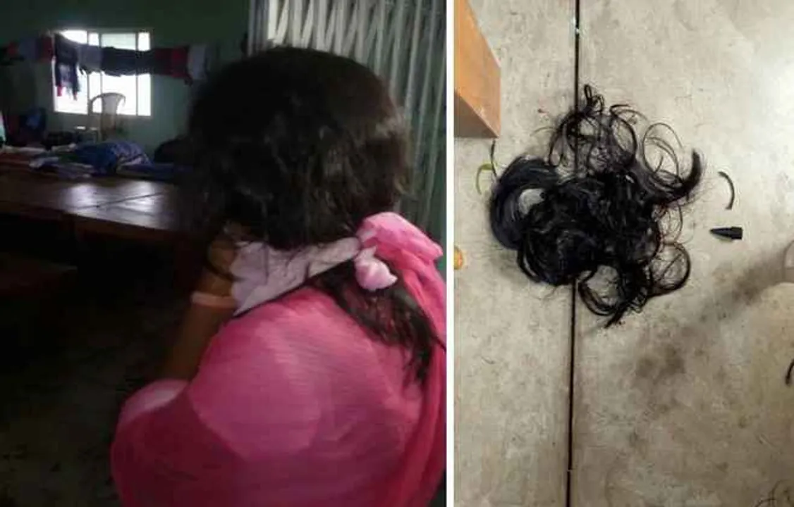  Odisha nursing student alleges ragging as hair cut off, face smeared