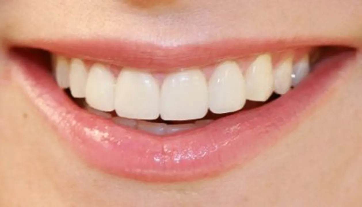  Diabetes may increase gum disease risk