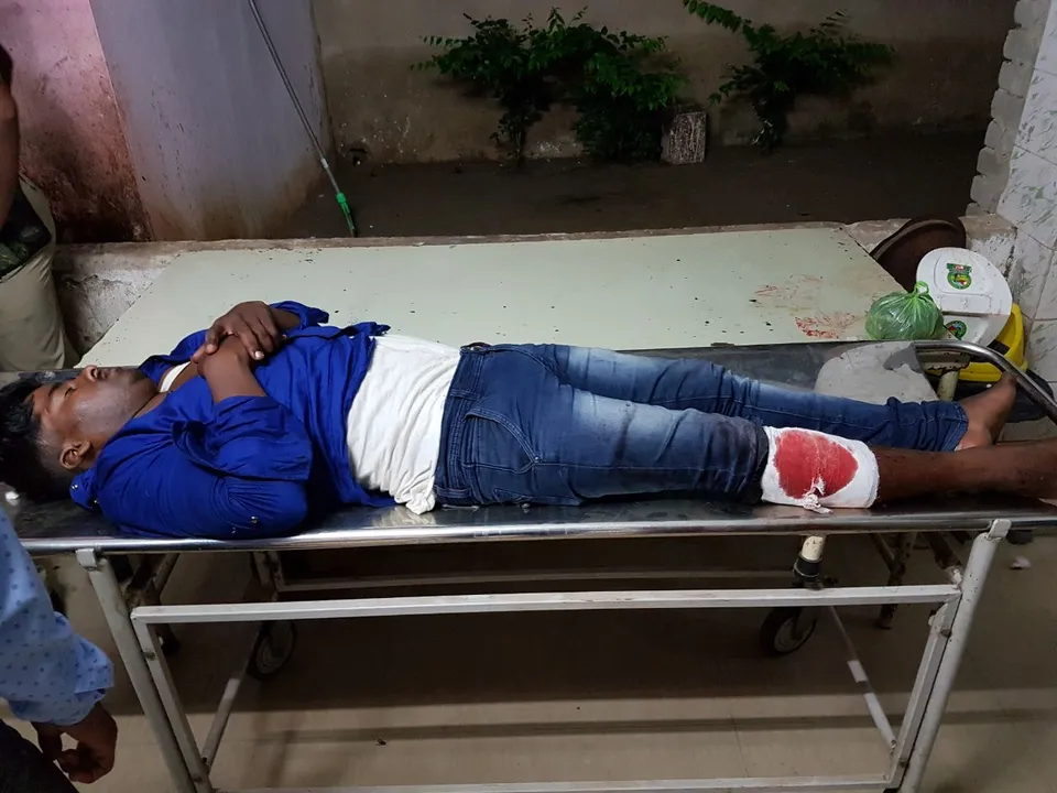  Dreaded criminal injured in police encounter on Puri-Konark marine drive road