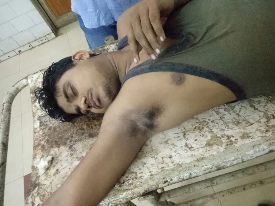  Criminal injured in police encounter in Odisha's Puri