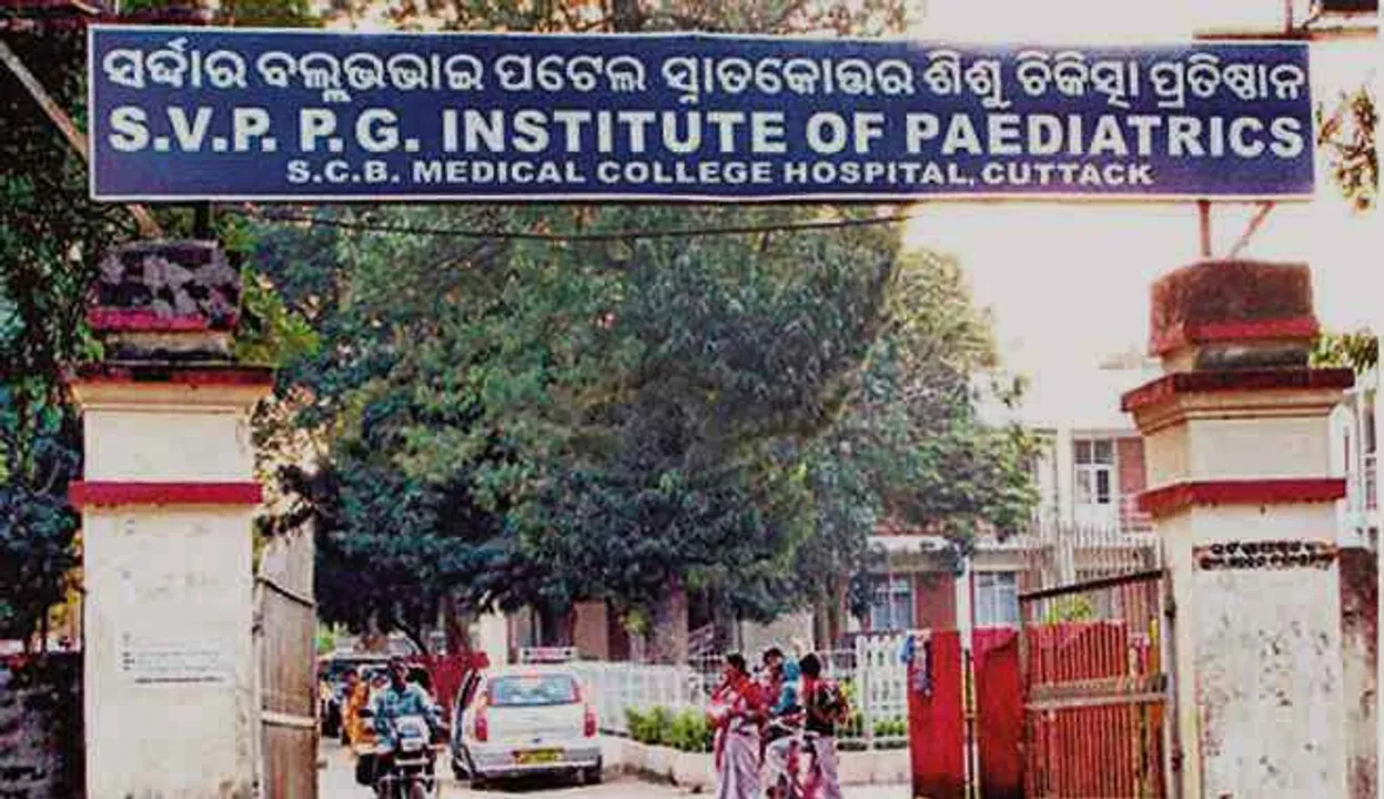  Special team formed for treatment of Odisha conjoined twins