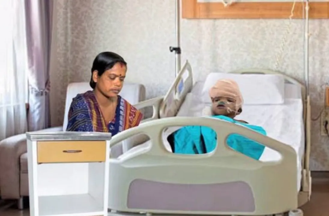  Odisha twins Jaga-Kalia shifted to ward from ICU
