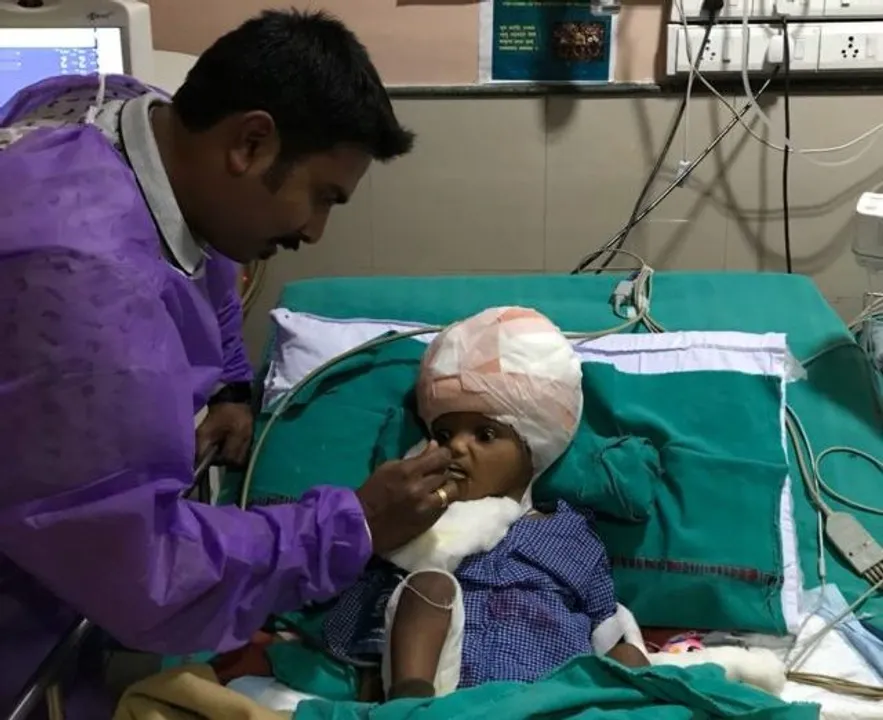  One of Odisha twins Kalia feeling drowsy. Here's why