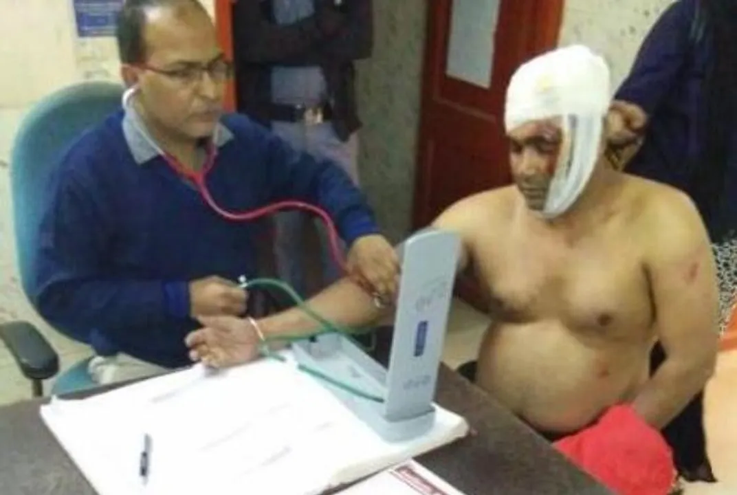  Masked men attack RPF staff in Odisha; hospitalised