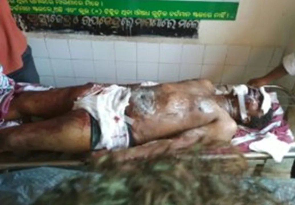  Gift packet explodes while unwrapping in Odisha; two killed