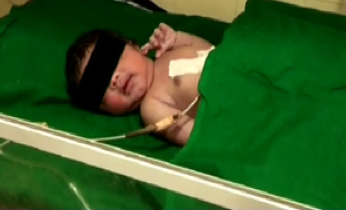  Abandoned newborn girl rescued in Odisha's Angul