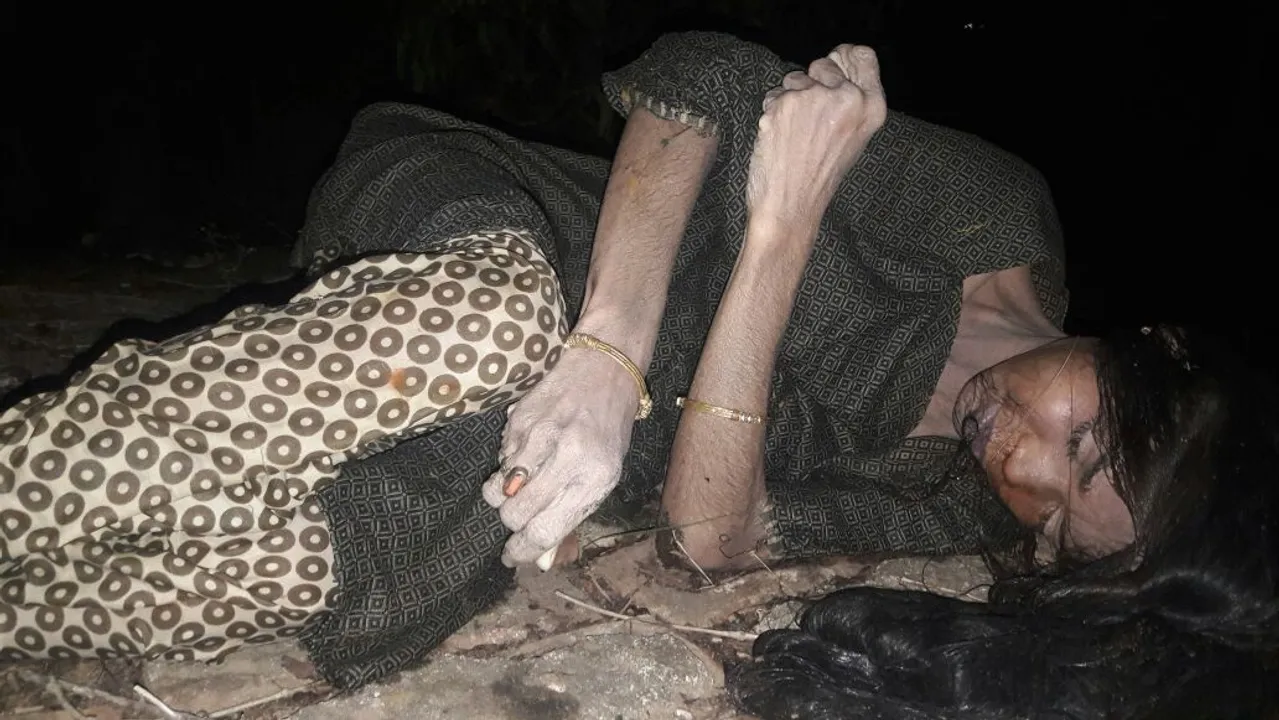  Missing lady doc’s body found from well in Odisha capital