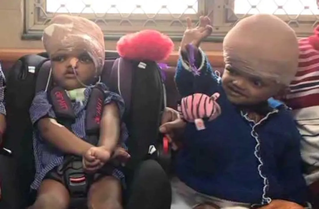  The wait continues for Odisha twins Jaga-Kalia