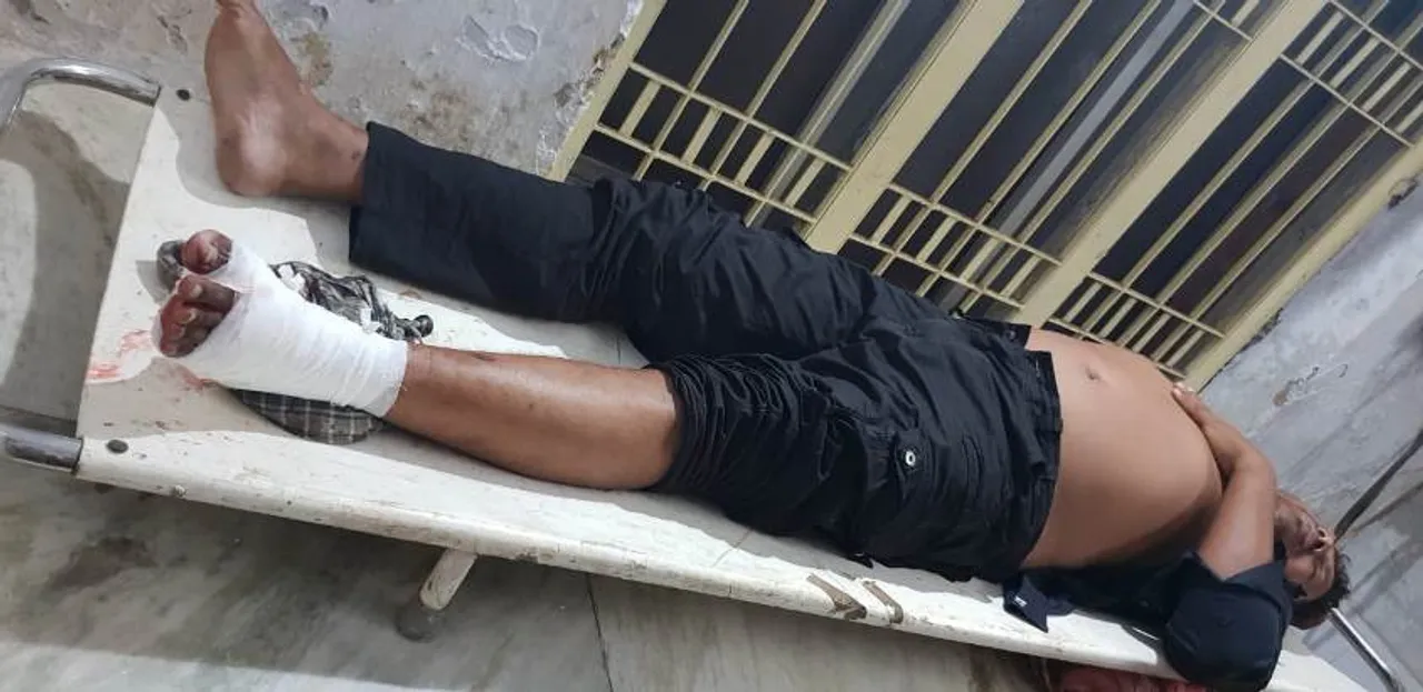  Notorious criminal injured in police encounter in Odisha's Puri