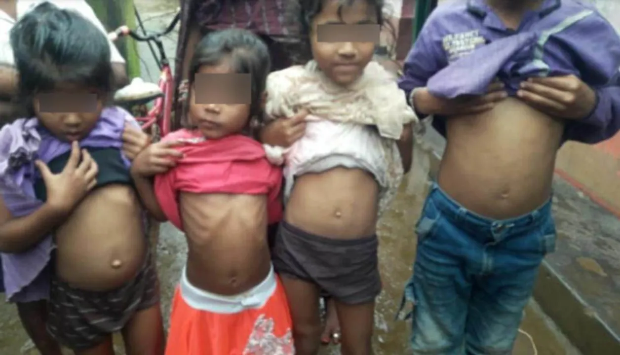  In Odisha village, 23 kids branded with hot iron for ‘healthy life’