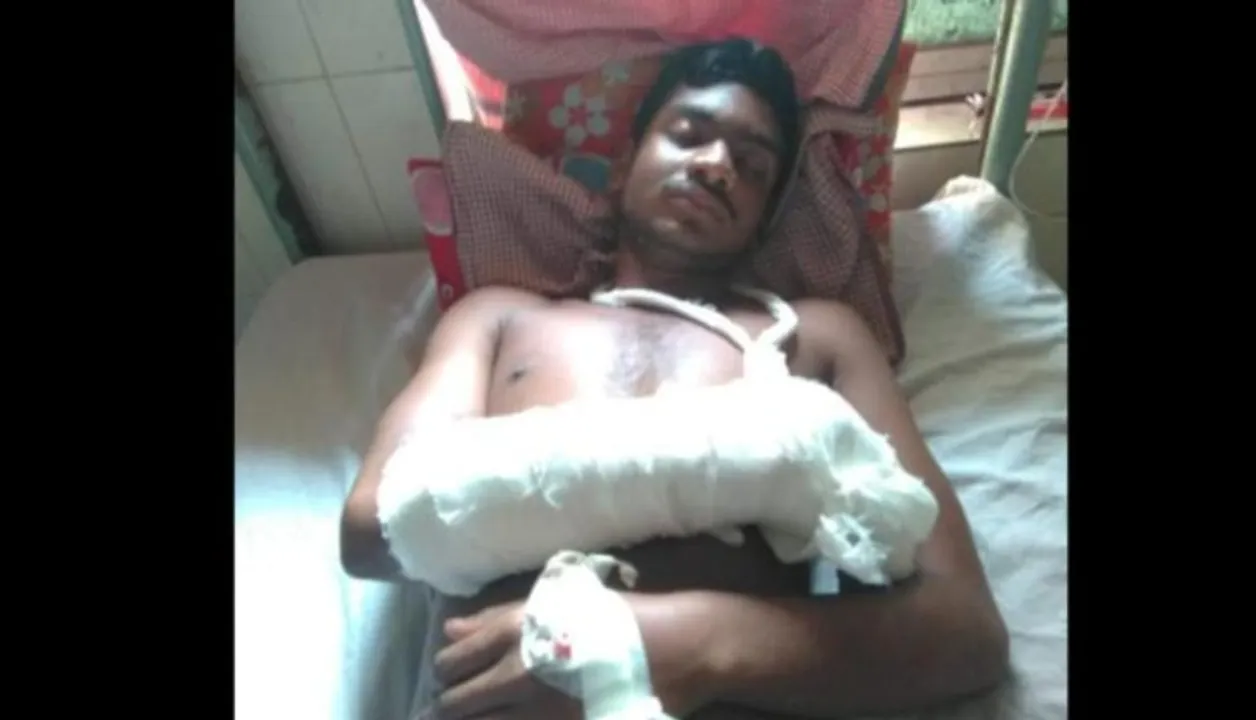  Momo challenge: Youth cuts hand in Cuttack; hospitalised    