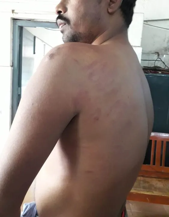  Odisha: Three students of Utkal University arrested for attacking journalist