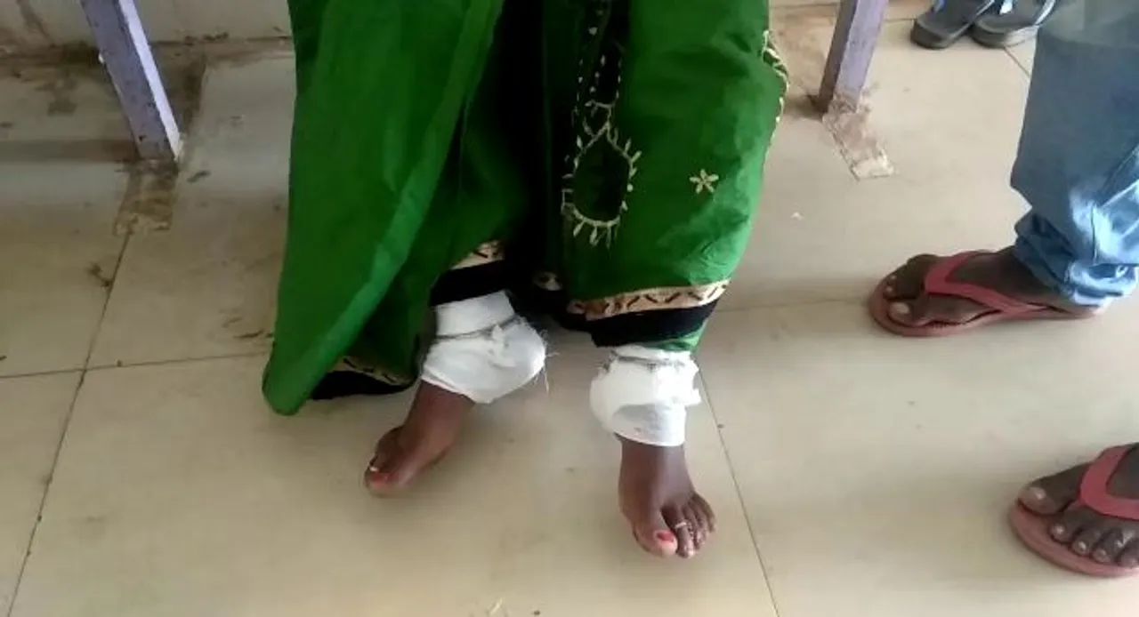  Operation on 'wrong' leg doubles woman's pain in Odisha's Keonjhar