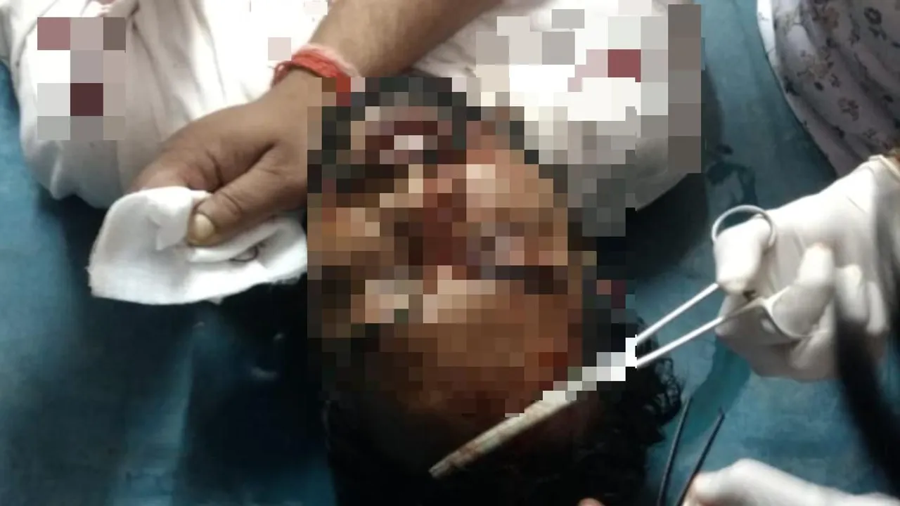  BJD MLA candidate's brothers critical in knife attack in Odisha