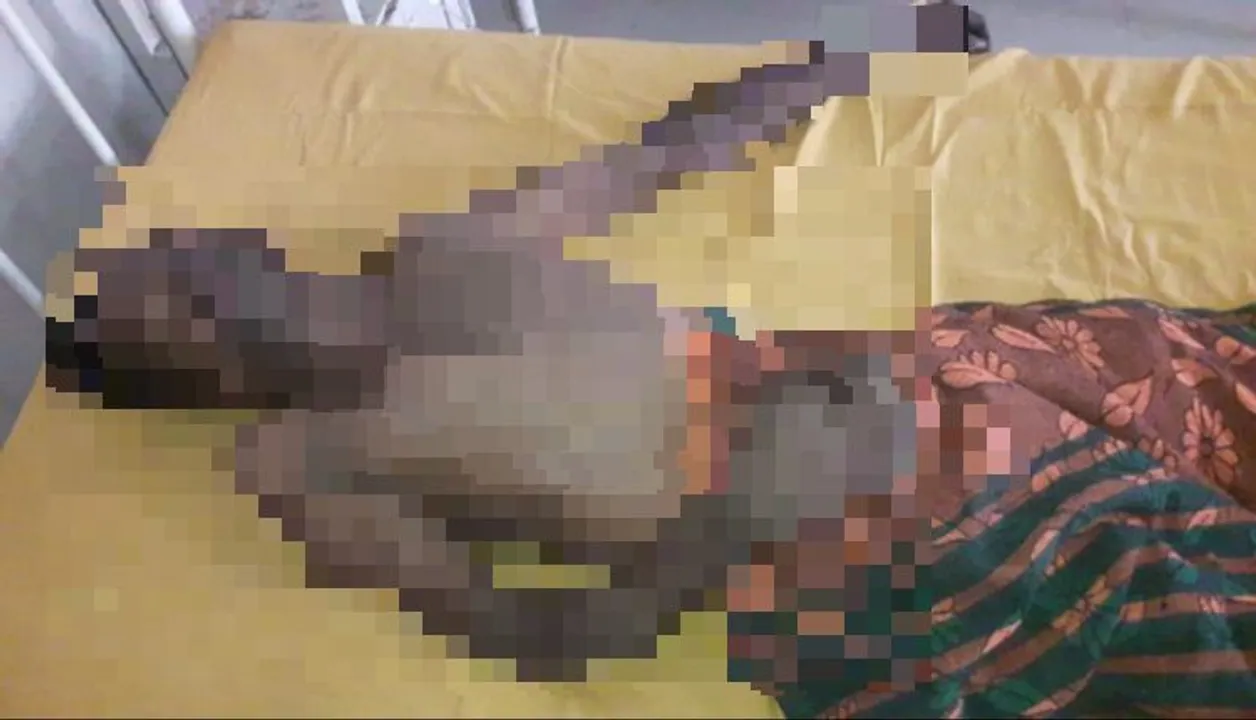  Odisha man dies of electrocution while saving father