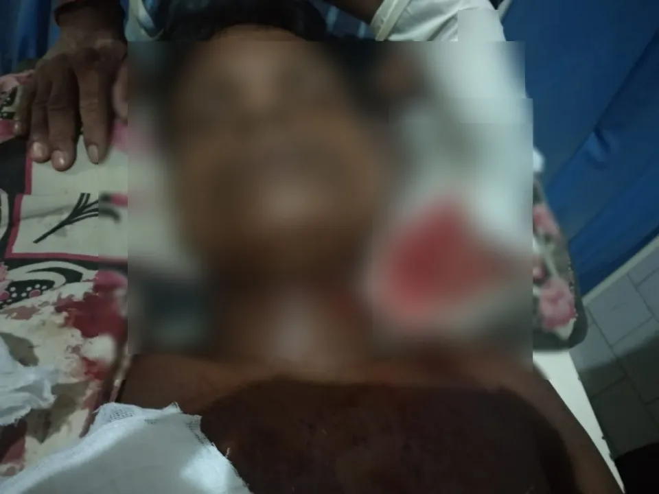 Odisha: Man’s throat slit while sleeping on terrace