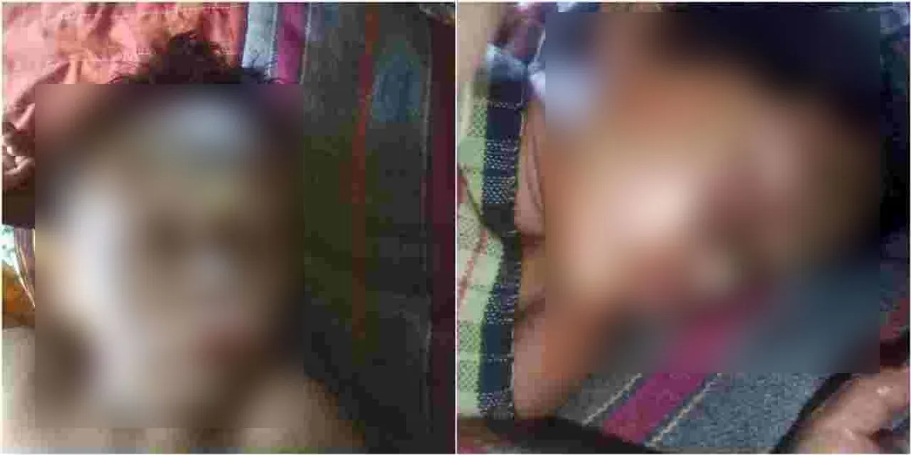  Brother-sister duo injured in fireworks explosion in Odisha