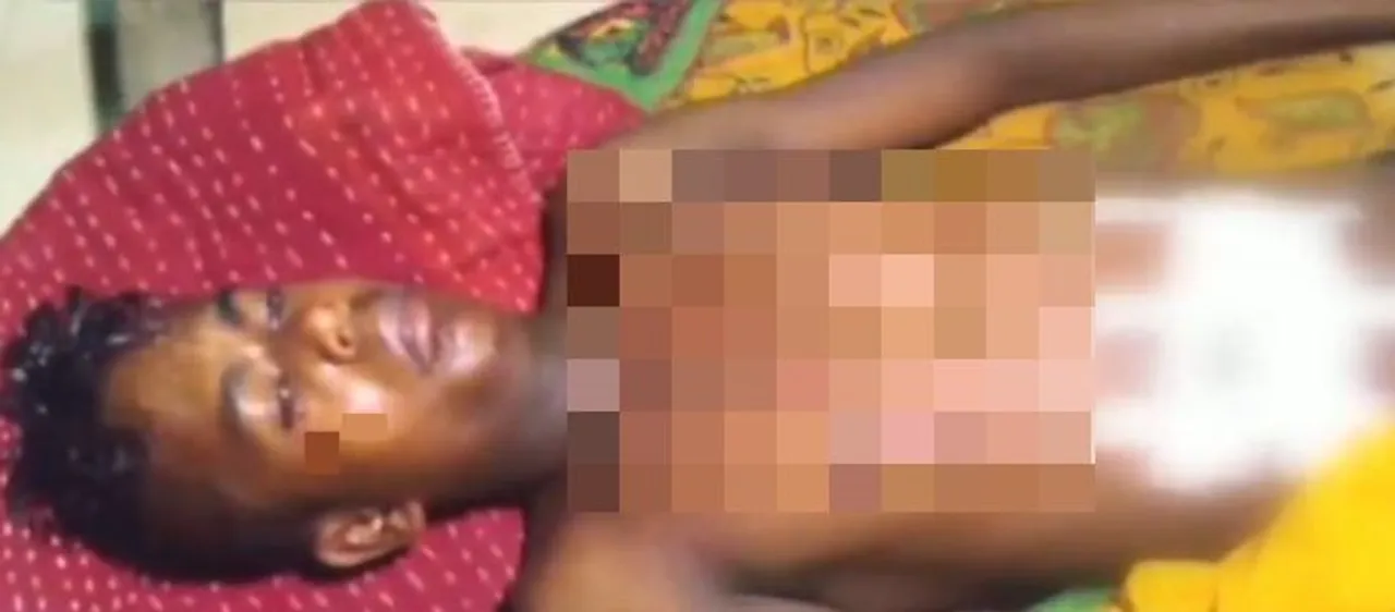  Mobile phone explosion leaves minor boy critical in Odisha