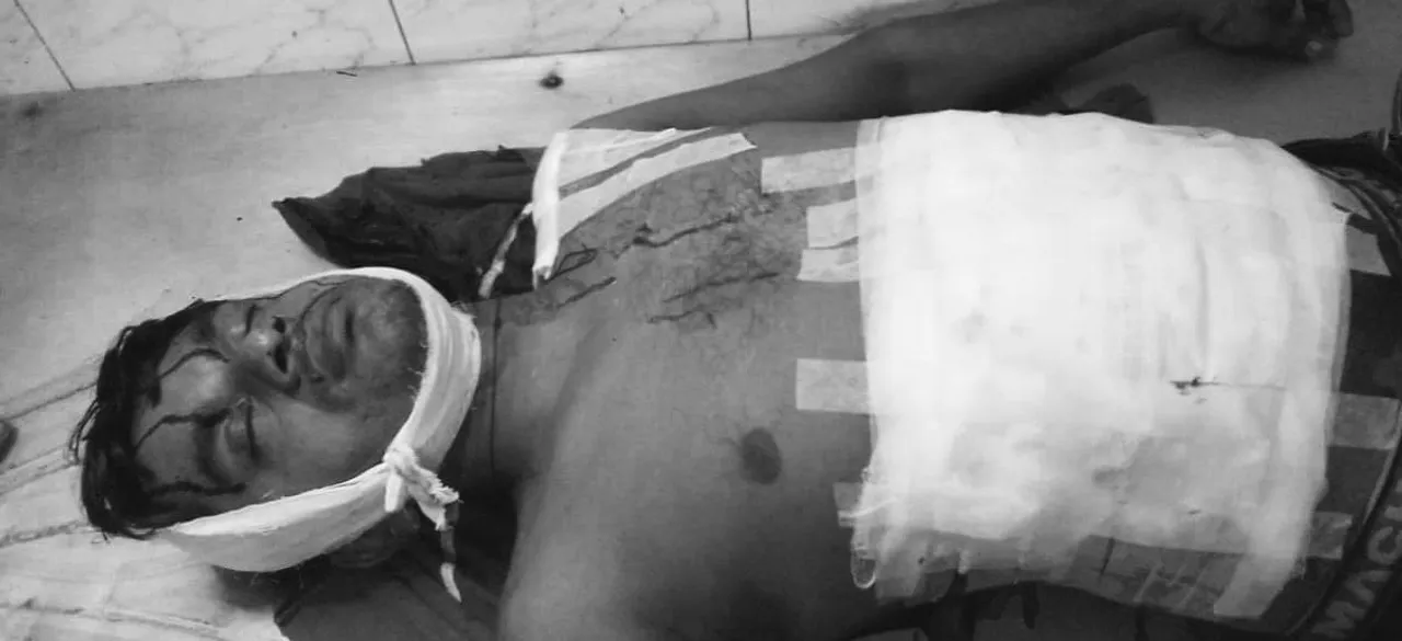  Odisha man attempts to kill son-in-law over love marriage