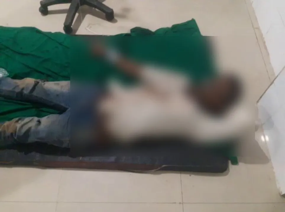  Youth attacked with acid in Odisha's Angul; critical